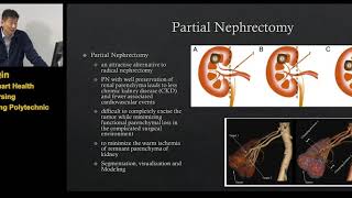 Computer-assisted Surgery Based on Deep Learning and Virtual Reality Techniques